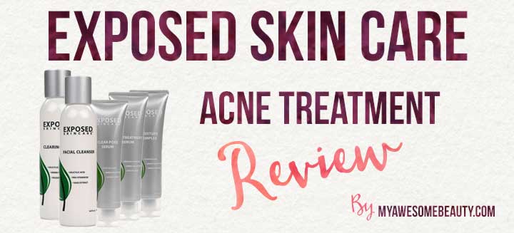 Exposed skin care reviews to read before buying anything