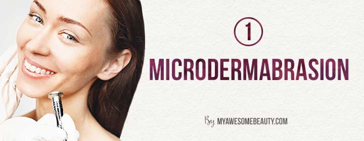 microdermabrasion for acne scars