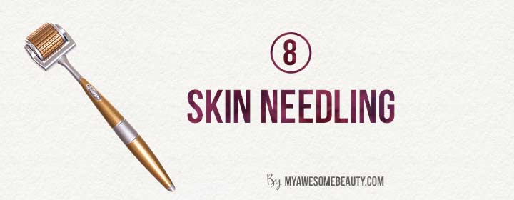 skin needling