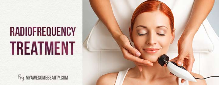 radiofrequency treatment