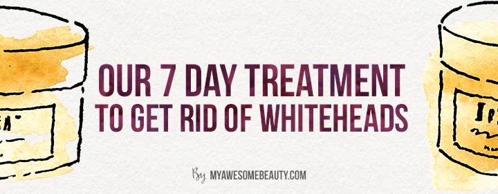 our 7 day treatment to get rid of whiteheads