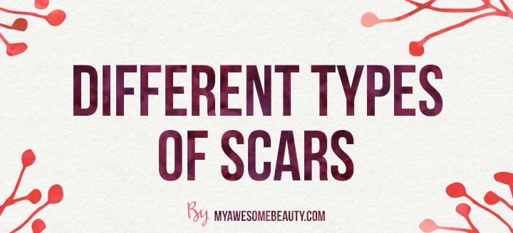different types of scars