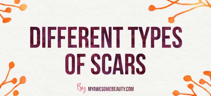 the different types of scars