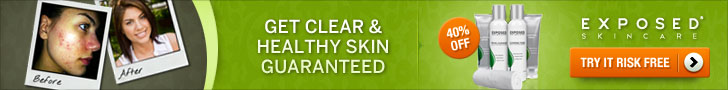 exposed skincare banner