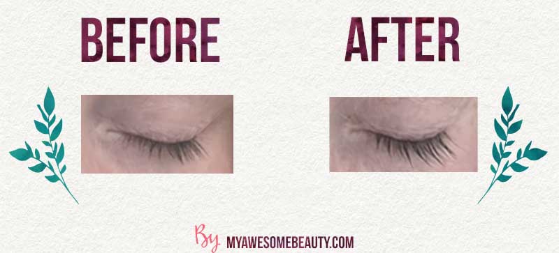 castor oil before and after